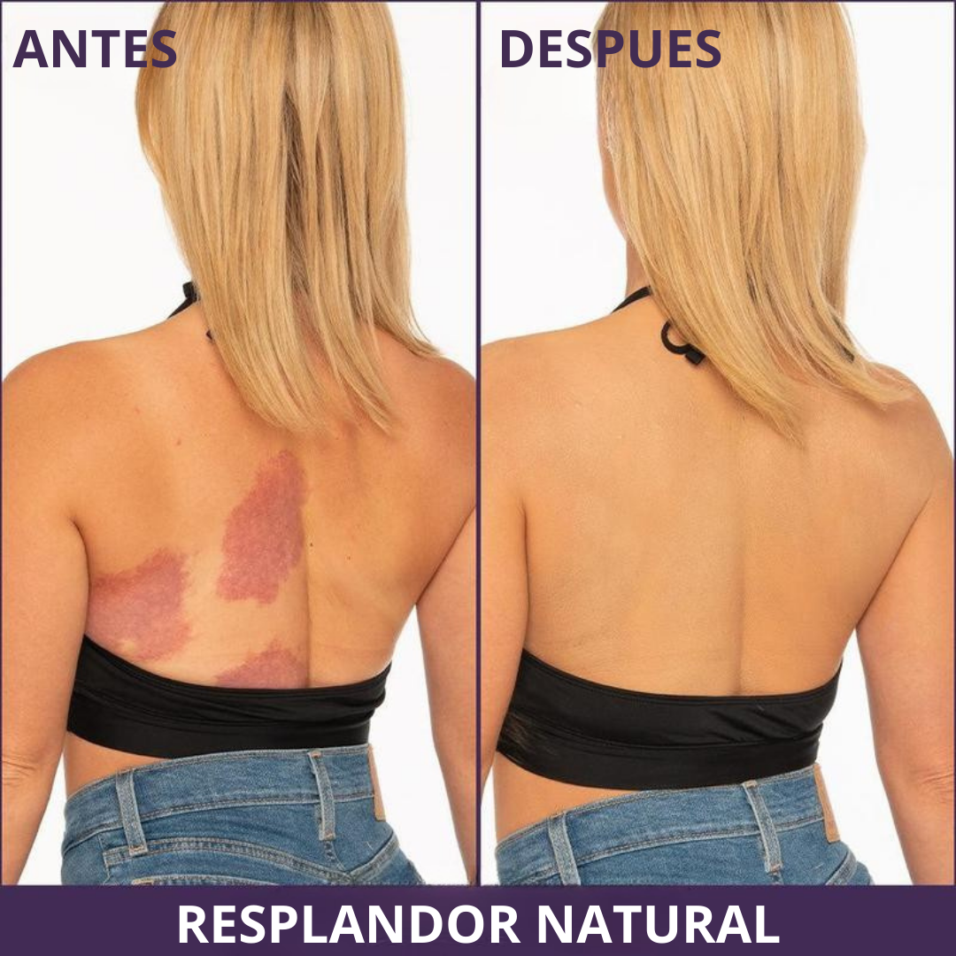 Maquillaje Corporal de Alta Cobertura para Piernas y Cuerpo (OFERTA 2X1)
